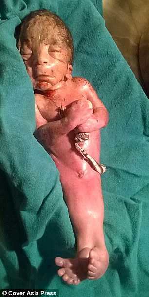 gorgona2_aftodioikisi