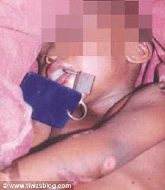 πατέρας-έβαλε-λουκέτο-στο-στόμα-του-μω-229218