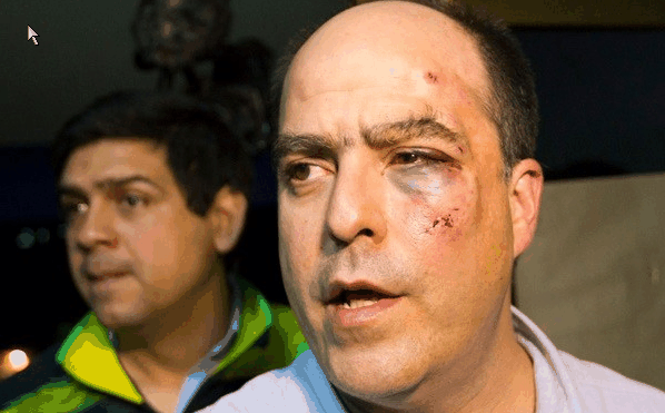 άγριο-ξύλο-στο-κοινοβούλιο-της-βενεζο-259012