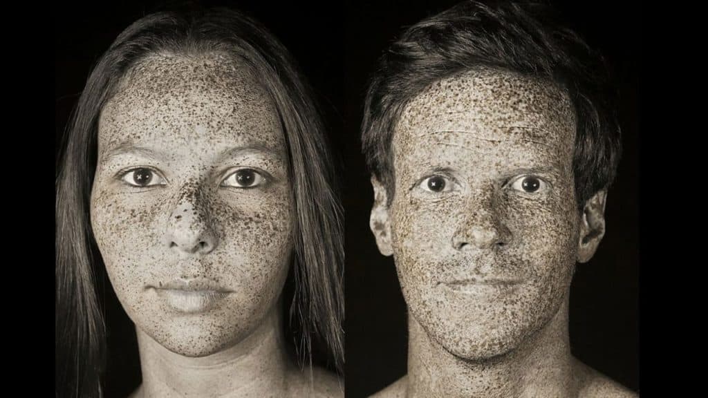 οι-βλάβες-που-προκαλεί-ο-ήλιος-στο-δέρμ-605826