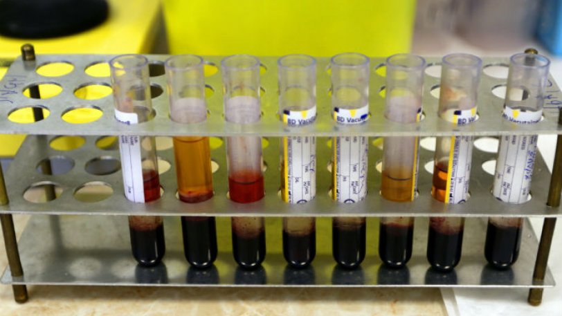 νεογέννητο-έγινε-ο-νεότερος-ασθενής-σ-731923