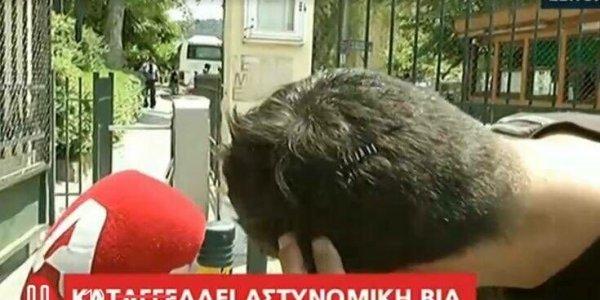 βία-από-αστυνομικούς-της-ελασ-εναντίο-781109
