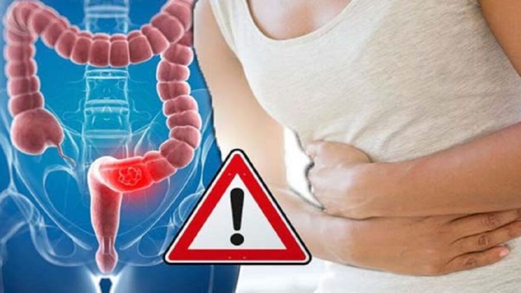 καρκίνος-παχέος-εντέρου-η-έλλειψη-βιτ-844798