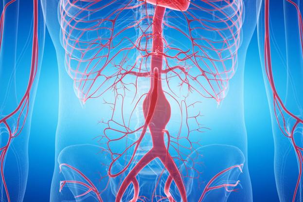 ανεύρυσμα-κοιλιακής-αορτής-ο-παράγον-859116