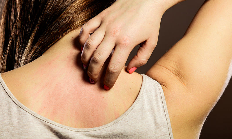 ξηροδερμία-με-ποια-προβλήματα-υγείας-900503