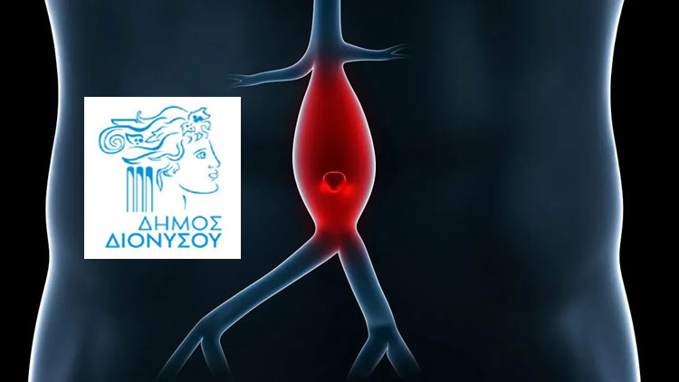 δωρεάν-εξέταση-για-ανεύρυσμα-κοιλιακ-1137963