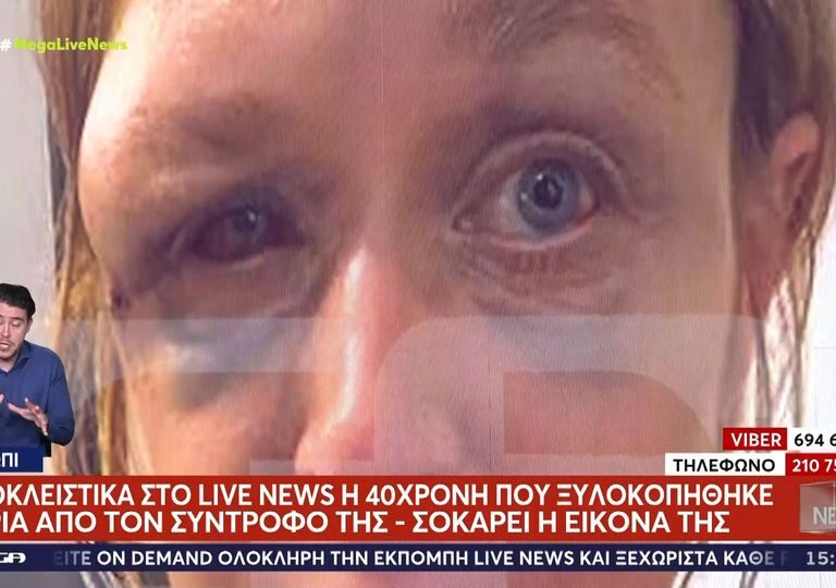 κορωπί-σοκάρει-η-εικόνα-της-40χρονης-απ-1506647