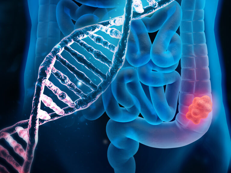 πρόληψη-και-έγκαιρη-διάγνωση-κλειδί-1532160