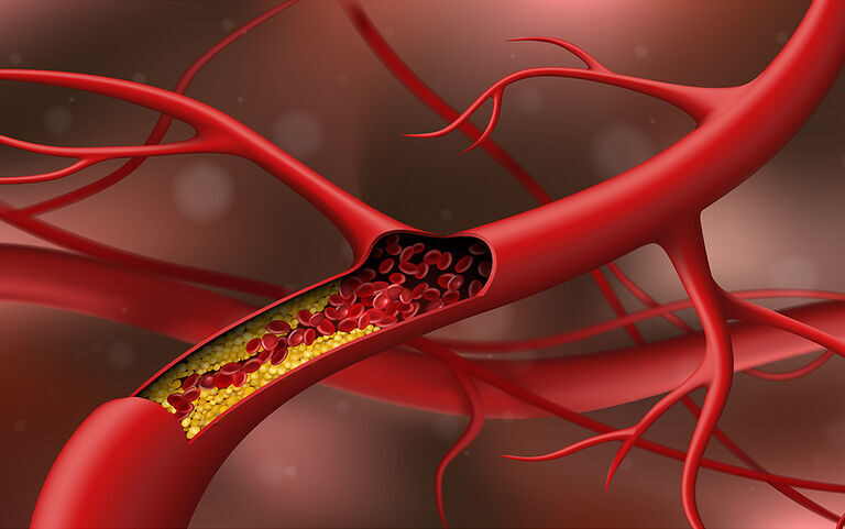 ιρανικό-πλήγμα-σε-βάση-στη-σαουδική-αρ-1563277